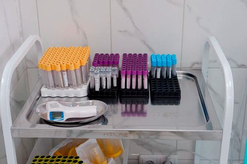 Стол с ампулами для анализов